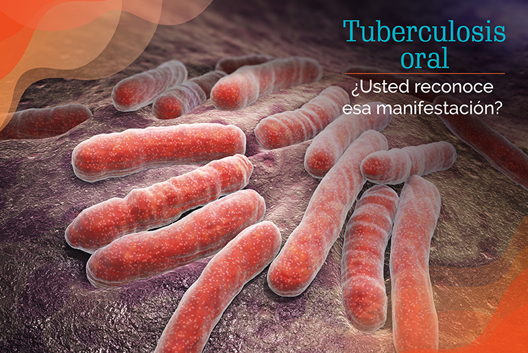 Tuberculosis Oral